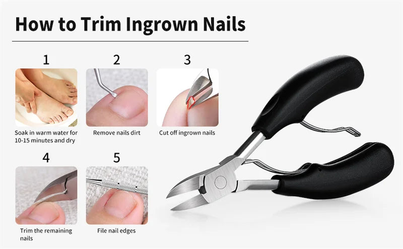 Nail Clippers Ingrown Toenail Podiatry Correction Nippers Cuticle Cutters Cut Paronychia Pedicure Manicure Hand Foot Care Tool